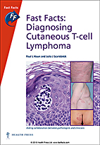 Fast Facts: Diagnosing Cutaneous T-Cell Lymphoma (book cover, edition 2016)