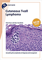 Fast Facts: Cutaneous T-cell Lymphoma (book cover, edition 2019)