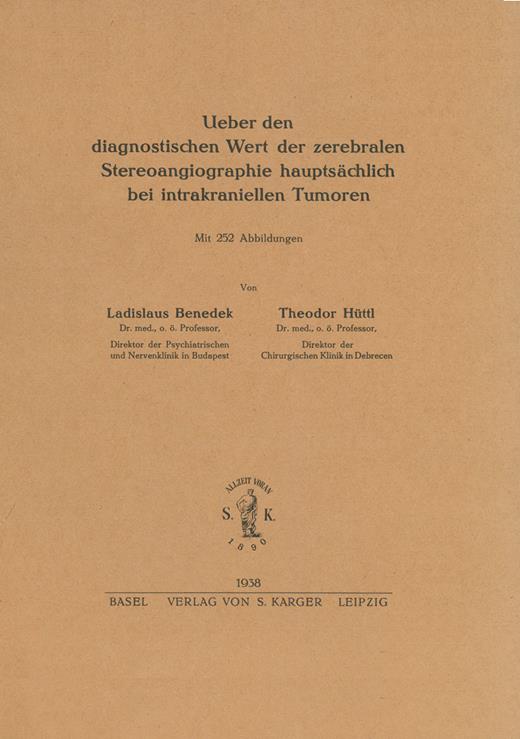 Book cover for Über den diagnostischen Wert der zerebralen Stereoangiographie: Hauptsächlich bei intrakraniellen Tumoren