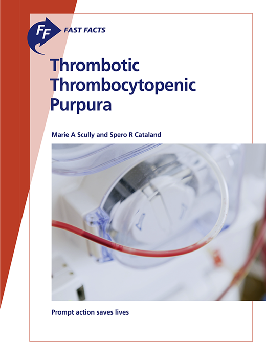 Book cover for Fast Facts: Thrombotic Thrombocytopenic Purpura: Prompt action saves lives