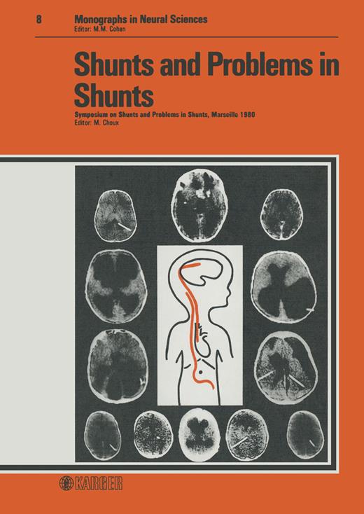 Radiology of Shunt Complications in Childhood Hydrocephalus | Shunts ...