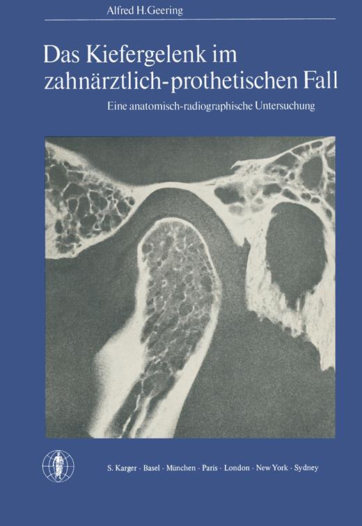 Book cover for Das Kiefergelenk im zahnärztlich-prothetischen Fall: Eine anatomisch-radiographische Untersuchung