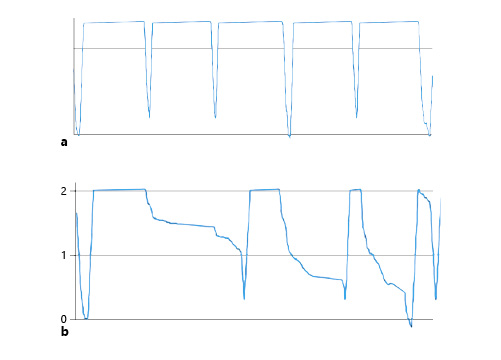 Cycle profiles. a Tidal PD with a good working catheter. b Impact of constipation.