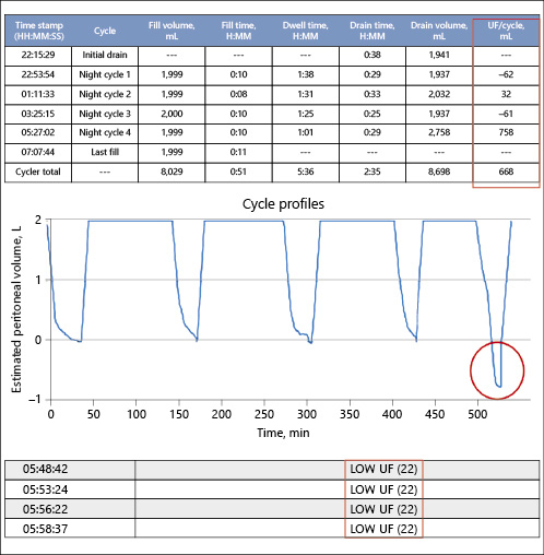 Sharesource daily treatment summary. UF, ultrafiltration.