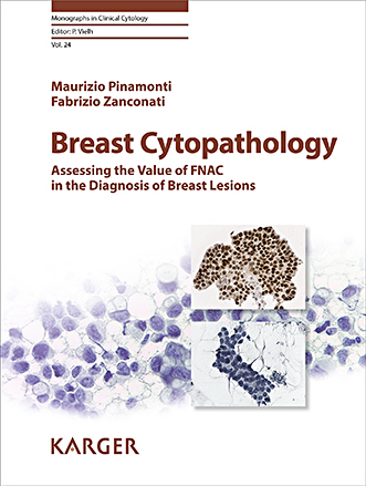 Book cover for Breast Cytopathology: Assessing the Value of FNAC in the Diagnosis of Breast Lesions