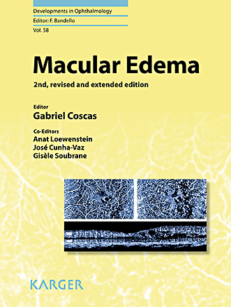 Book cover for Macular Edema
