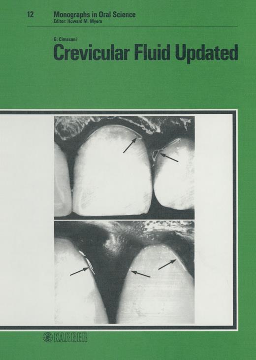 Book cover for Crevicular Fluid Updated