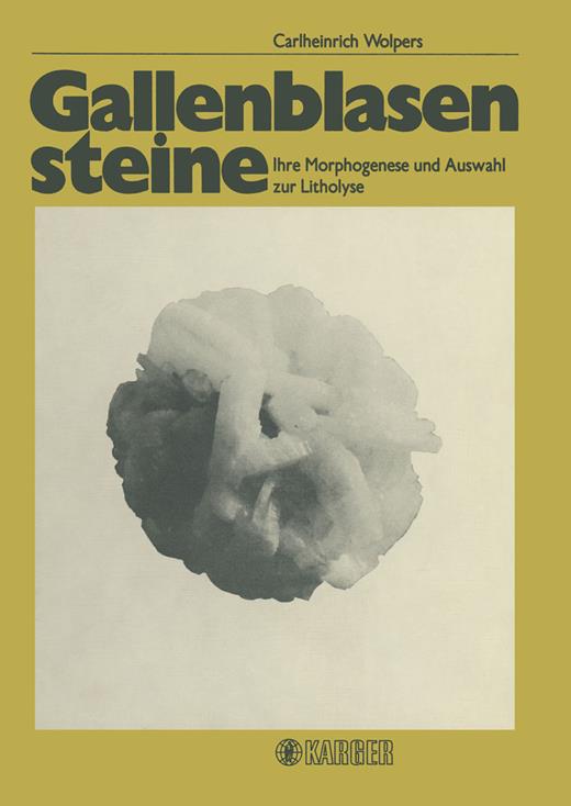 Book cover for Gallenblasensteine: Ihre Morphogenese und Auswahl zur Litholyse