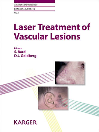 Book cover for Laser Treatment of Vascular Lesions