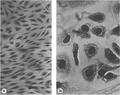 Microscopic picture of early passage (‘young') fibroblasts (a) and fibroblasts at the end of their replicative potential (b). Photos by L. Hayflick, reproduced with permission.