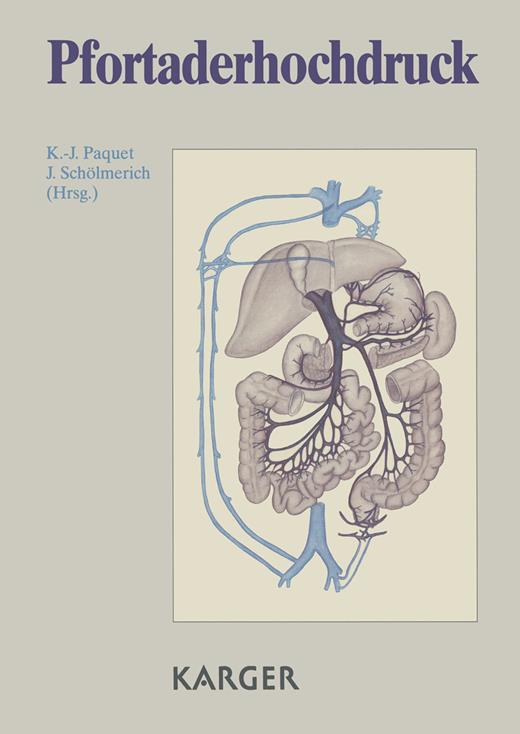 Book cover for Pfortaderhochdruck