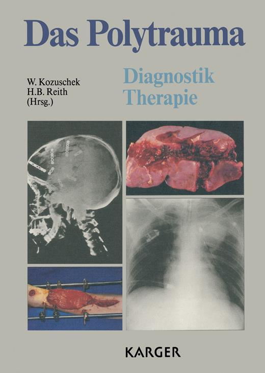Book cover for Das Polytrauma: Diagnostik Therapie