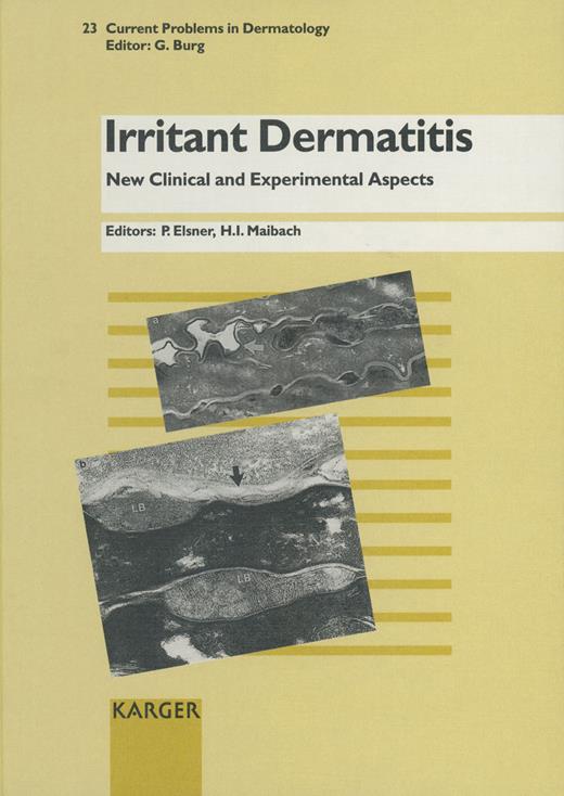 Metalworking Fluid Dermatitis A Comparative FollowUp Study in