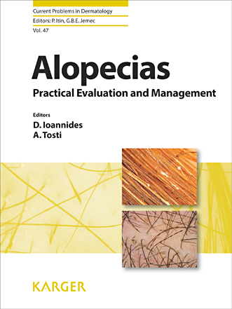 Book cover for Alopecias - Practical Evaluation and Management
