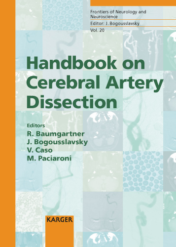 Book cover for Handbook on Cerebral Artery Dissection