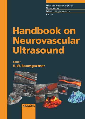 Book cover for Handbook on Neurovascular Ultrasound