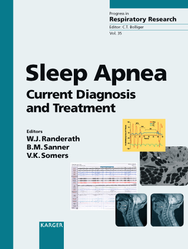 Book cover for Sleep Apnea: Current Diagnosis and Treatment