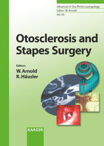 Book cover for Otosclerosis and Stapes Surgery