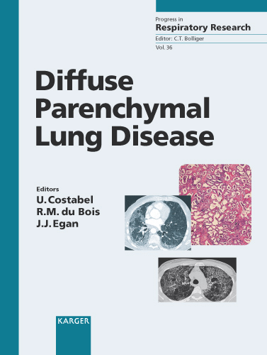 Book cover for Diffuse Parenchymal Lung Disease