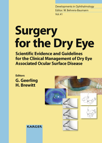 Book cover for Surgery for the Dry Eye: Scientific Evidence and Guidelines for the Clinical Management of Dry Eye Associated Ocular Surface Disease