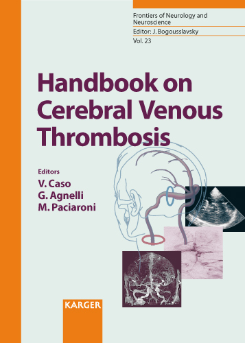 Book cover for Handbook on Cerebral Venous Thrombosis