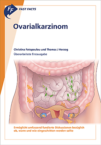 Book cover for Fast Facts: Ovarialkarzinom