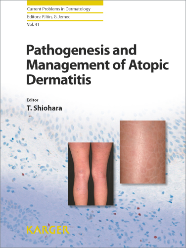 Book cover for Pathogenesis and Management of Atopic Dermatitis