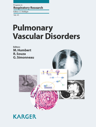 Book cover for Pulmonary Vascular Disorders