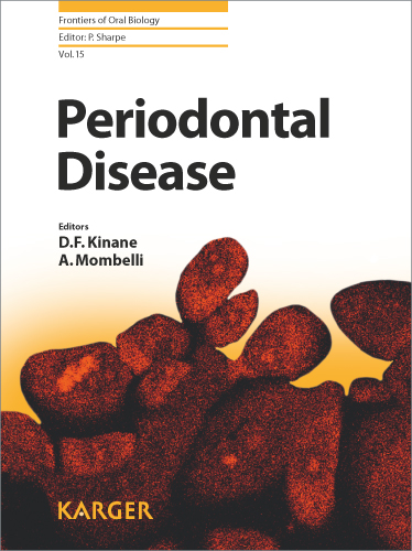 Book cover for Periodontal Disease