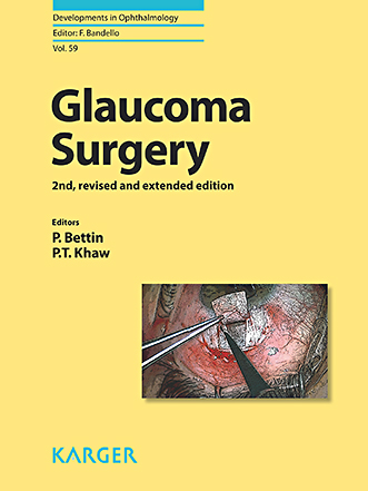 Book cover for Glaucoma Surgery