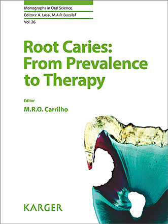 Book cover for Root Caries: From Prevalence to Therapy