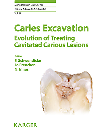 Book cover for Caries Excavation: Evolution of Treating Cavitated Carious Lesions