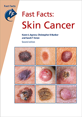 Book cover for Fast Facts: Skin Cancer