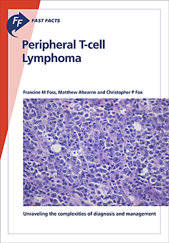 Book cover for Fast Facts: Peripheral T-cell Lymphoma: Unraveling the complexities of diagnosis and management