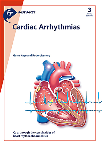 Book cover for Fast Facts: Cardiac Arrhythmias