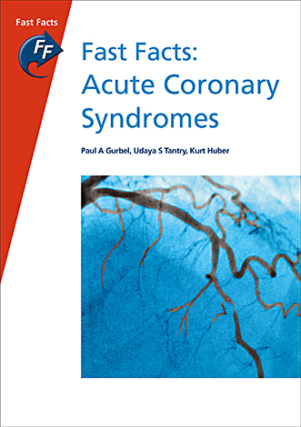 Book cover for Fast Facts: Acute Coronary Syndromes
