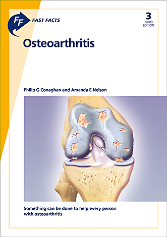 Book cover for Fast Facts: Osteoarthritis