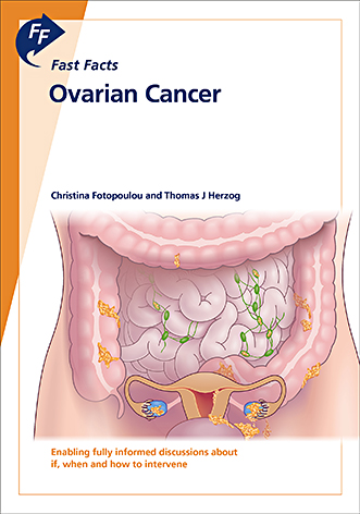 Book cover for Fast Facts: Ovarian Cancer