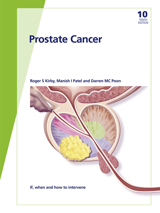 Book cover for Fast Facts: Prostate Cancer: If, when and how to intervene