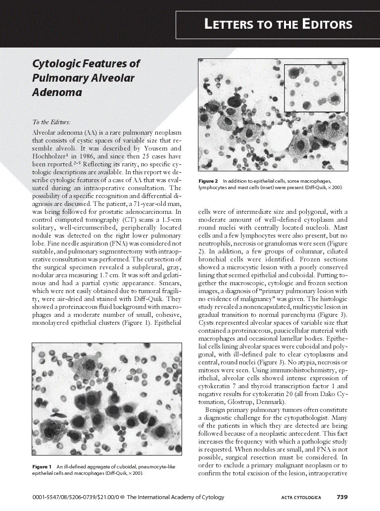 First page of Thyroid Paraganglioma: Diagnostic Pitfall in Fine Needle Aspiration Biopsy