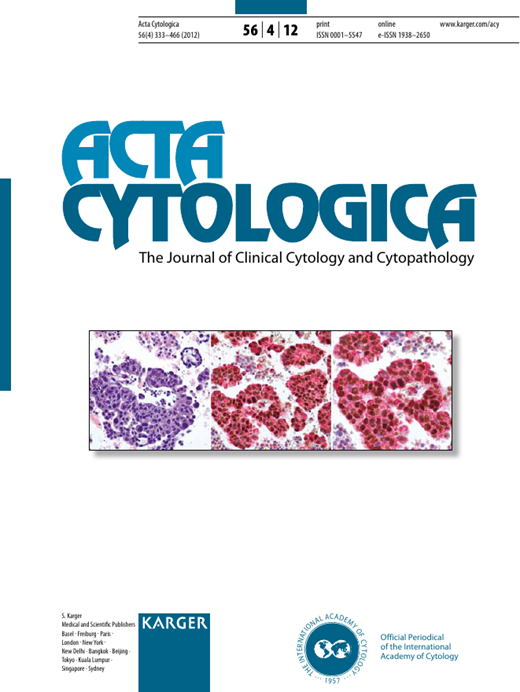 Fine-Needle Aspiration Cytology of Hyalinizing Trabecular Adenoma of ...