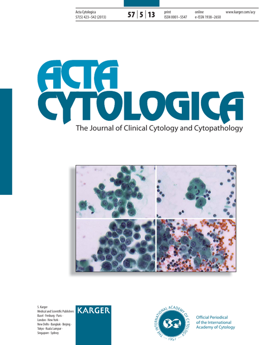 Acta Cytologica Cover Image for Volume 57, Issue 5