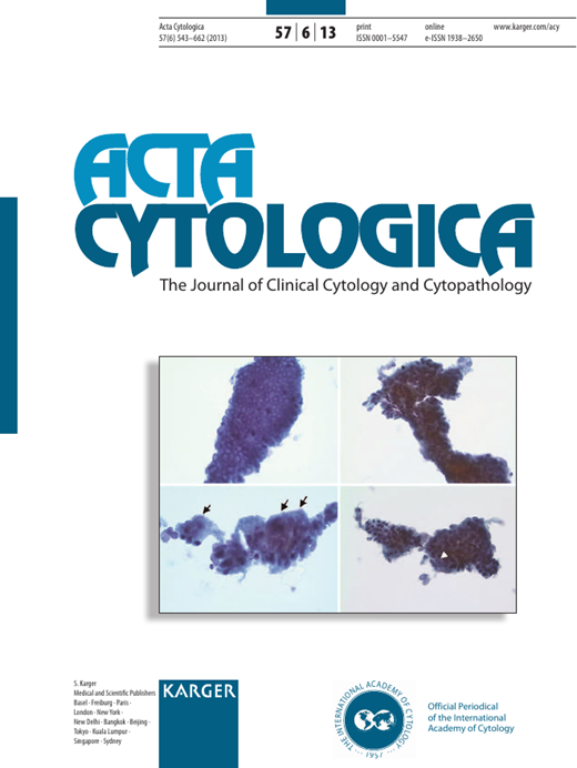 Acta Cytologica Cover Image for Volume 57, Issue 6