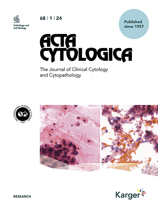 Imprint Cytology of Tall Cell Carcinoma with Reversed Polarity of the