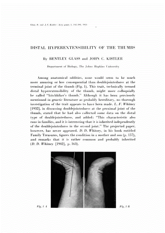 DISTAL HYPEREXTENSIBILITY OF THE THUMBS Acta et Statistica