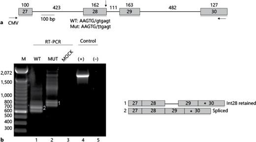 Fig. 3. IVS28 + 1G>T causes aberrant splicing of an OTOF minigene. a Schematic representation of the OTOF minigene. Boxes represent exons, and the lines represent introns. The sizes of the exons and introns are indicated. The horizontal arrows indicate PCR primers for RT-PCR detection of minigene RNA: CMV is a primer to a vector-derived portion of the minigene RNA. The 5′ splice site of exon 28 is indicated with a vertical arrow, and shown below is the sequence of the wild-type and mutant 5′ splice sites, with exon sequences in capital letters, the junction denoted by the slash, and intron sequences in lower case. The mutation is underlined. b RT-PCR analysis of RNA isolated from 293T cells transfected with the wild-type (WT) and mutant (mut) minigenes. Mock, mock-transfected cells. Controls were the wild-type plasmid DNA (+) and water was the negative control (-). To the right are depictions of the RNA forms represented by the PCR products. The asterisks denote a cryptic 3′ss that generates the lower band in each lane, which was determined by DNA sequencing of the excised bands.