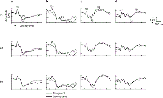 Fig. 1. a Grand average waveforms to congruent (grey) and incongruent (black) stimuli from three midline electrodes (Fz, Cz, Pz) from older NH listeners that did not exhibit the N4 potential (n = 7). b Averaged waveforms from CI subject 7 depicting N1 and P3. c NH subject 3 depicting N1, P3, and N4. d CI subject 6 depicting N1, P3, and N4. Stimulus onset is indicated by the upward arrow.