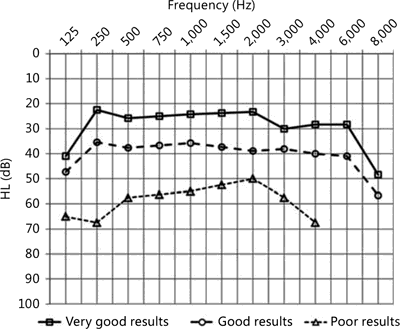 Fig. 3. Mean results of free-field pure-tone audiometry in elderly patients before and after cochlear implantation with regard to the three groups of patients (according to implantation benefits): very good (6 patients), good (20 patients) and poor (4 patients) performers.