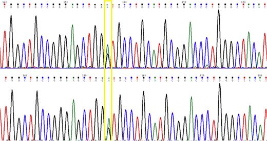 a Pedigree and segregation of the p.Gly104Asp variant in the ISF-13 family. The affected individual sequenced with WES is indicated with an arrow. b Sequencing results of the variant. c Right and left ear audiograms in patient V: 2. d Multiple amino acid alignment of protein homologs was conserved.