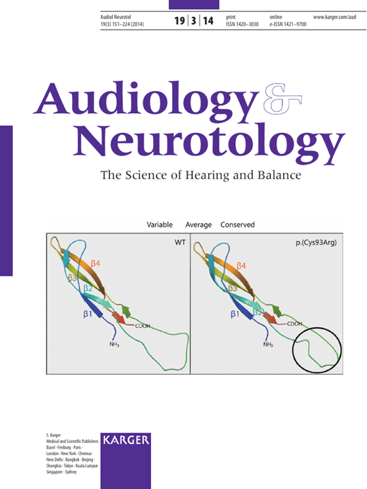 A Comparative Study on Speech in Noise Understanding with a Direct
